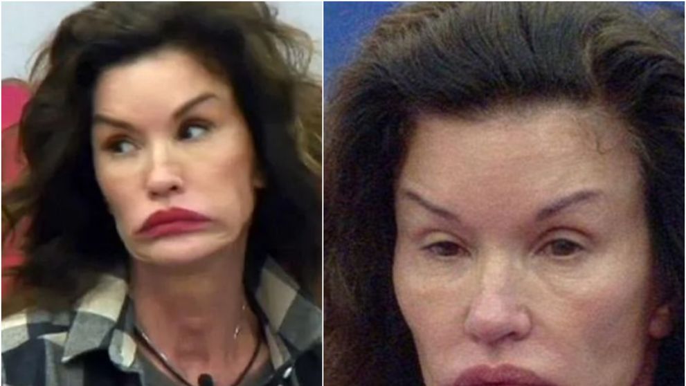 Primul supermodel al lumii a ajuns de nerecunoscut!  În tinerețe avea un chip perfect și corp de zeiță, dar operațiile estetice au mutilat-o! Prima intervenția și-a făcut-o când era iubita lui Sylvester Stallone