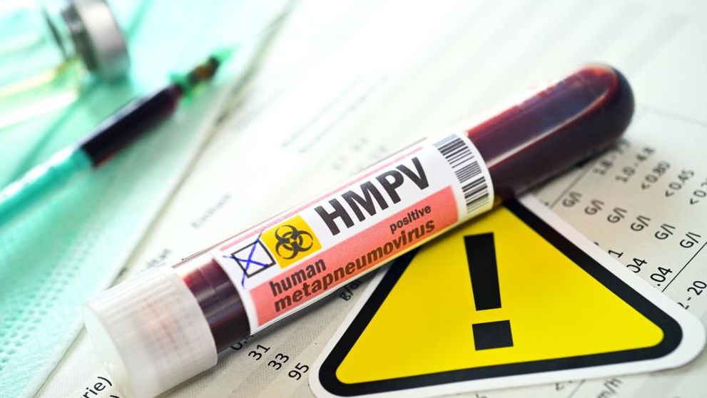 Primul caz de îmbolnăvire cu metapneumovirus (HMPV) a fost confirmat la Oradea. Femeia nu a călătorit în străinătate