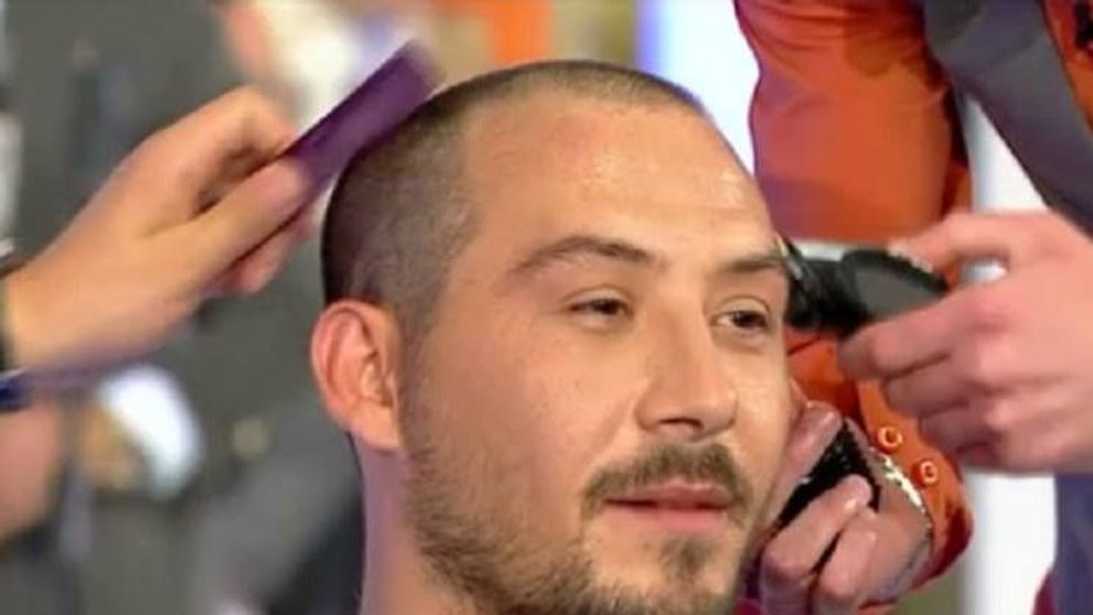 Stefan Stan a scapat de chelie dupa implantul de par. Primele rezultate se vad deja. Cum arata acum primul castigator de la 