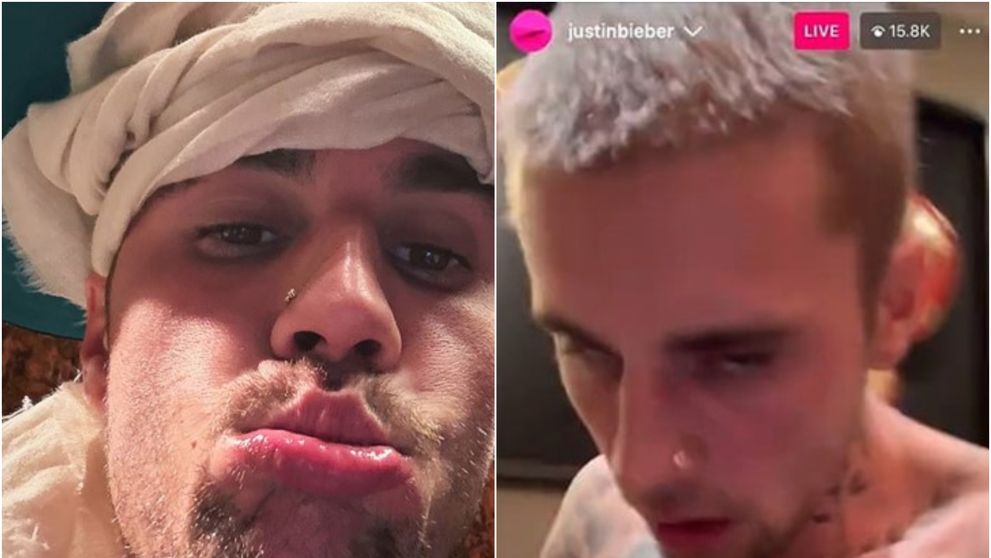 Justin Bieber, într-o stare alarmantă: Hailey Bieber cere disperată ajutor pentru soțul ei! 