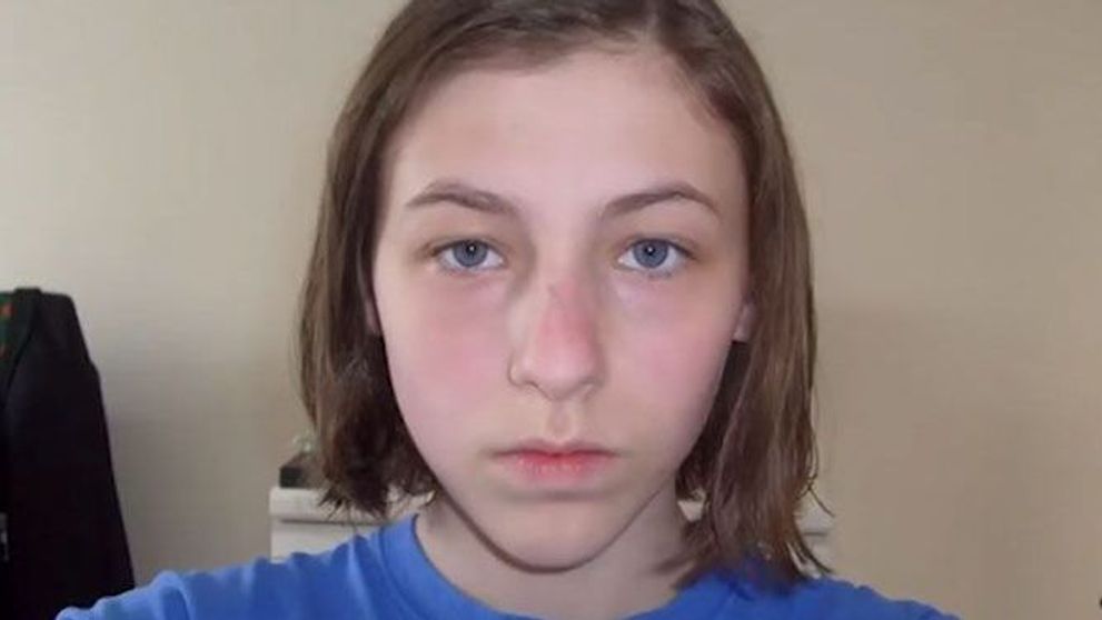 Timp de 8 ani, o adolescenta si-a facut zilnic cate un selfie. In ultima fotografie este greu de recunoscut