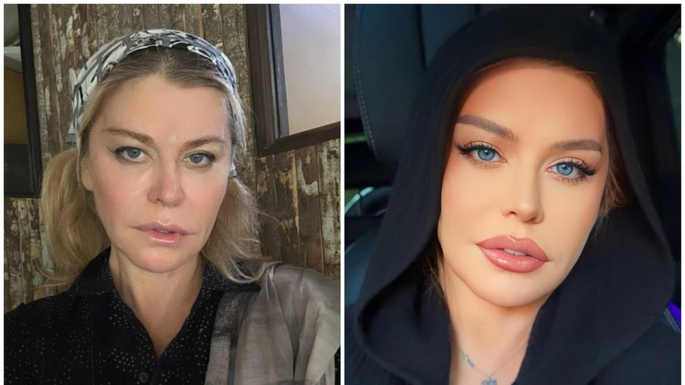 Loredana nu își mai ascunde chipul în spatele filtrelor de înfrumusețare. Vedeta a început să posteze mai multe imagini cu look-ul său real