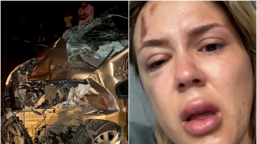 Emily Burghelea are nevoie de operații după tragicul accident de mașină! Vedeta este aproape desfigurată: „Alerg prin spitale!”
