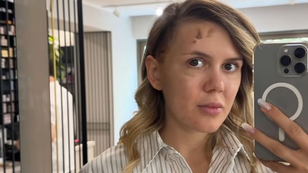 Noi detalii despre starea de sănătate a lui Emily Burghelea. „Ceva mă sperie și mă neliniștește profund”