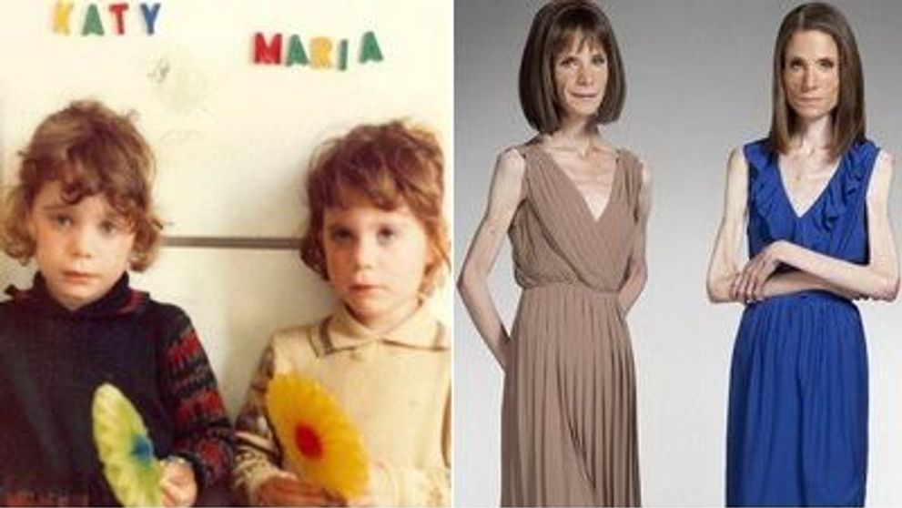 Gemene identice, anorexice, cu vietile distruse! Merita? FOTO